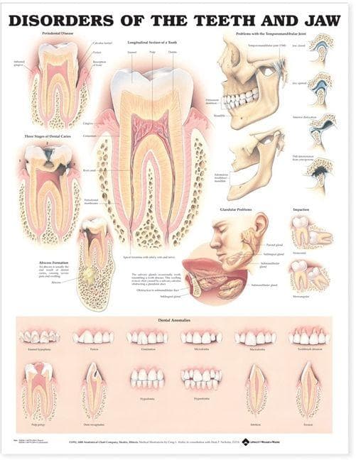 DISORDERS OF TEETH & JAW PU