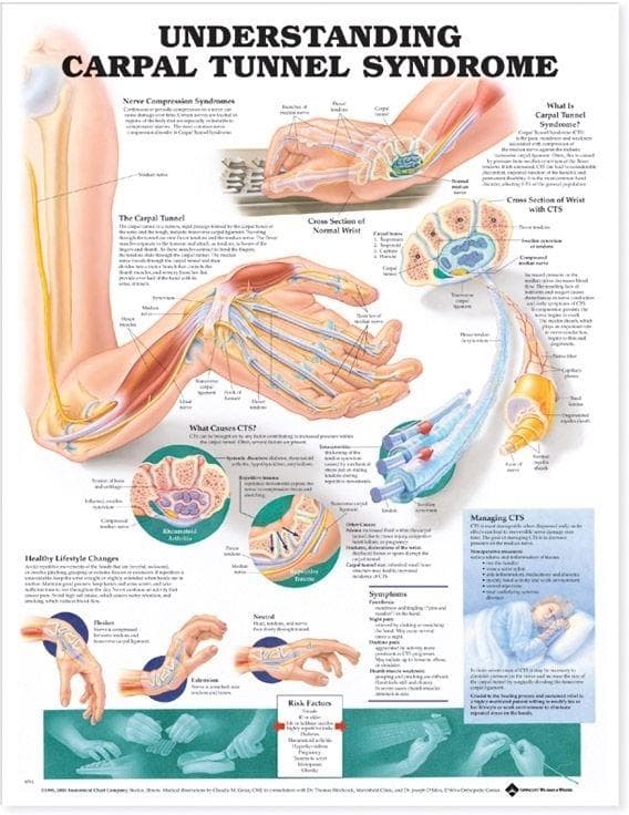 UNDERSTAND CARPAL TUNNEL PU