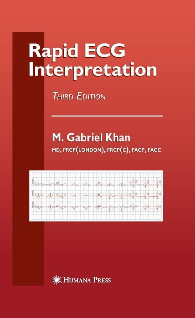Rapid ECG Interpretation