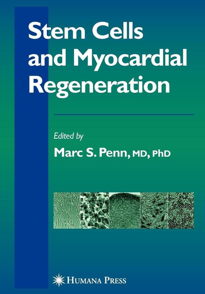 Stem Cells and Myocardial Regeneration