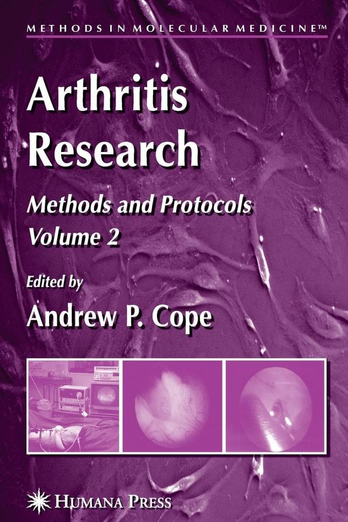 Arthritis Research