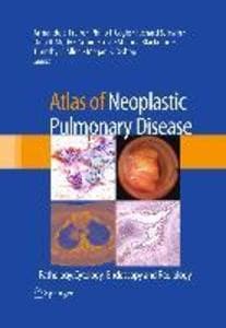 Atlas of Neoplastic Pulmonary Disease