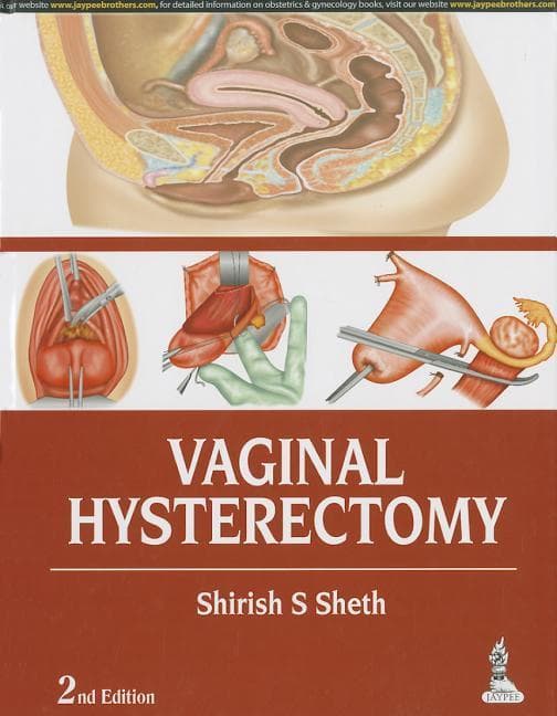 Vaginal Hysterectomy