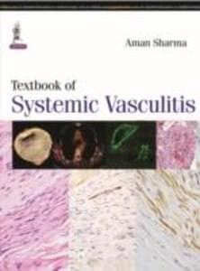 Textbook of Systemic Vasculitis