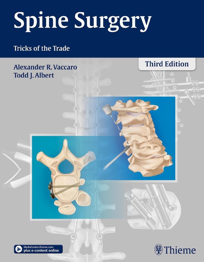 Spine Surgery