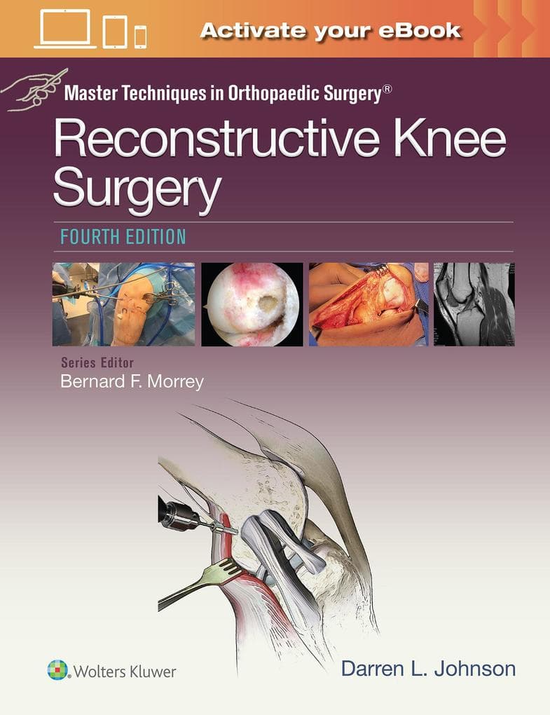 Master Techniques in Orthopaedic Surgery
