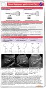 Sono Abdomen pocketcard Set
