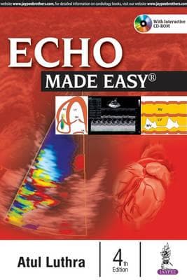 Echo Made Easy