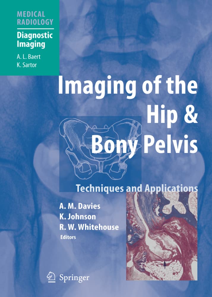 Imaging of the Hip & Bony Pelvis