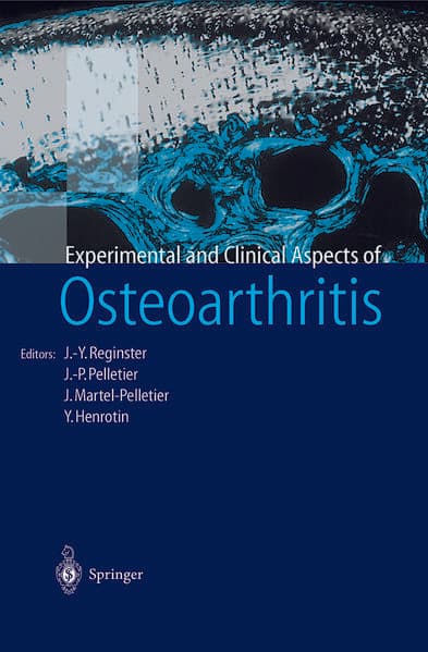 Osteoarthritis