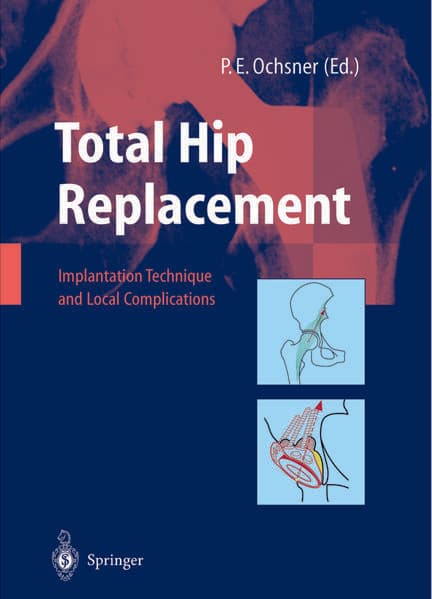 Total Hip Replacement