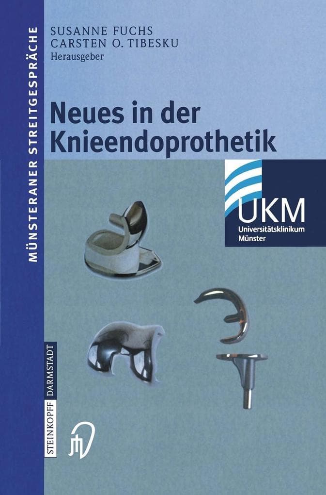 Neues in der Knieendoprothetik