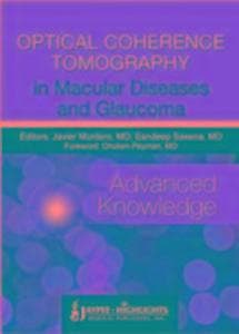 Optical Coherence Tomography in Macular Diseases and Glaucoma