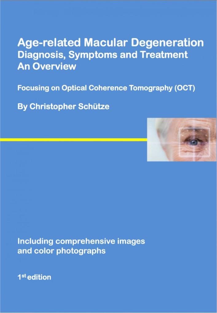 Age-related macular degeneration: Diagnosis, symptoms and treatment, an overview