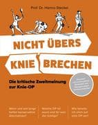 Nicht übers Knie brechen