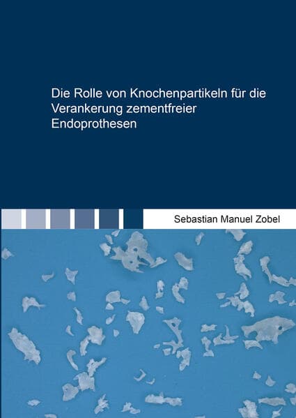 Die Rolle von Knochenpartikeln für die Verankerung zementfreier Endoprothesen
