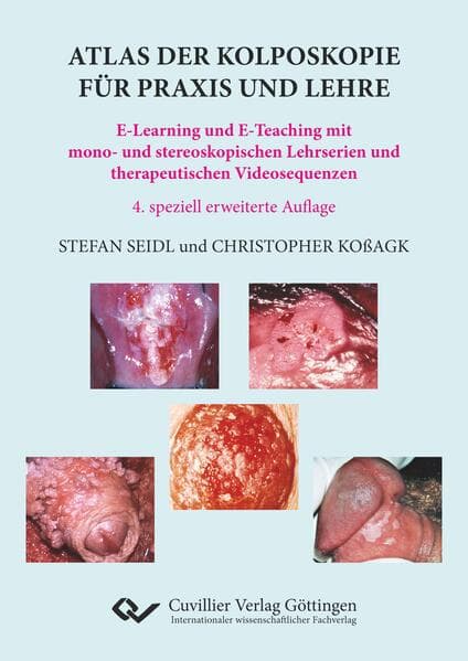 Atlas der Kolposkopie für Praxis und Lehre. E-Learning und E-Teaching mit mono- und stereoskopischen Lehrserien und therapeutischen Videosequenzen