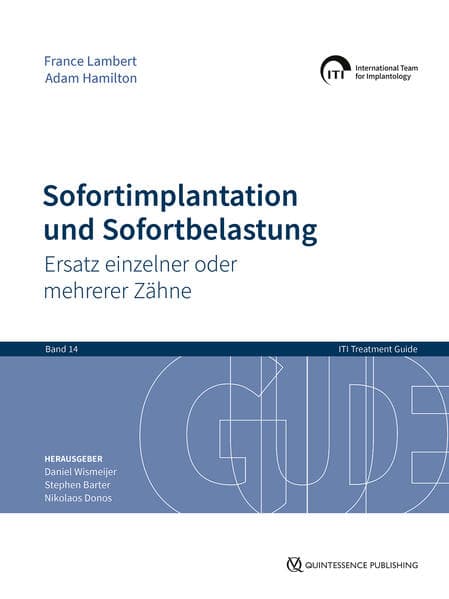 Sofortimplantation und Sofortbelastung
