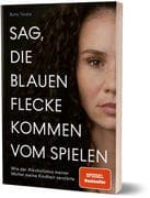 Sag, die blauen Flecke kommen vom Spielen