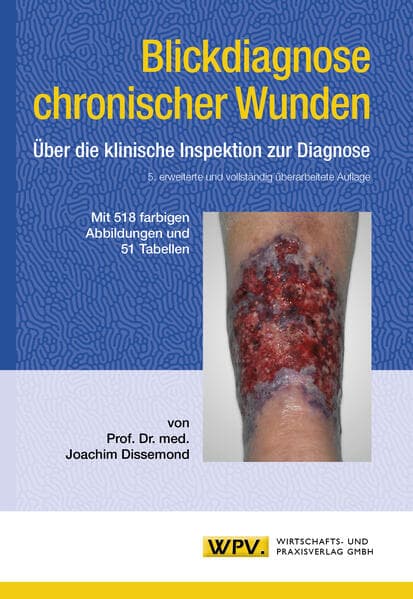 Blickdiagnose chronischer Wunden