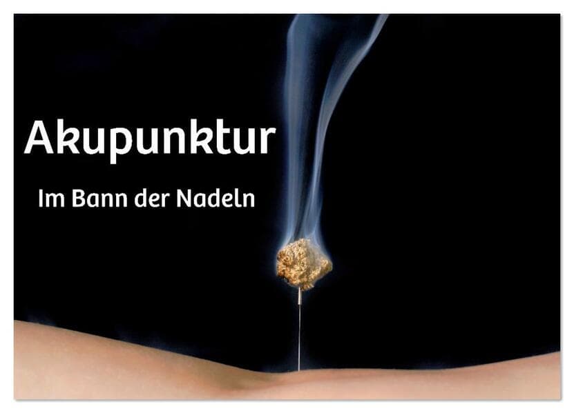 Akupunktur - Im Bann der Nadeln (Wandkalender 2026 DIN A4 quer), CALVENDO Monatskalender