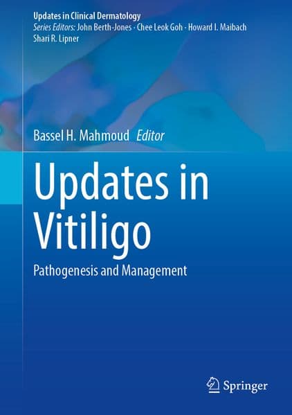 Updates in Vitiligo