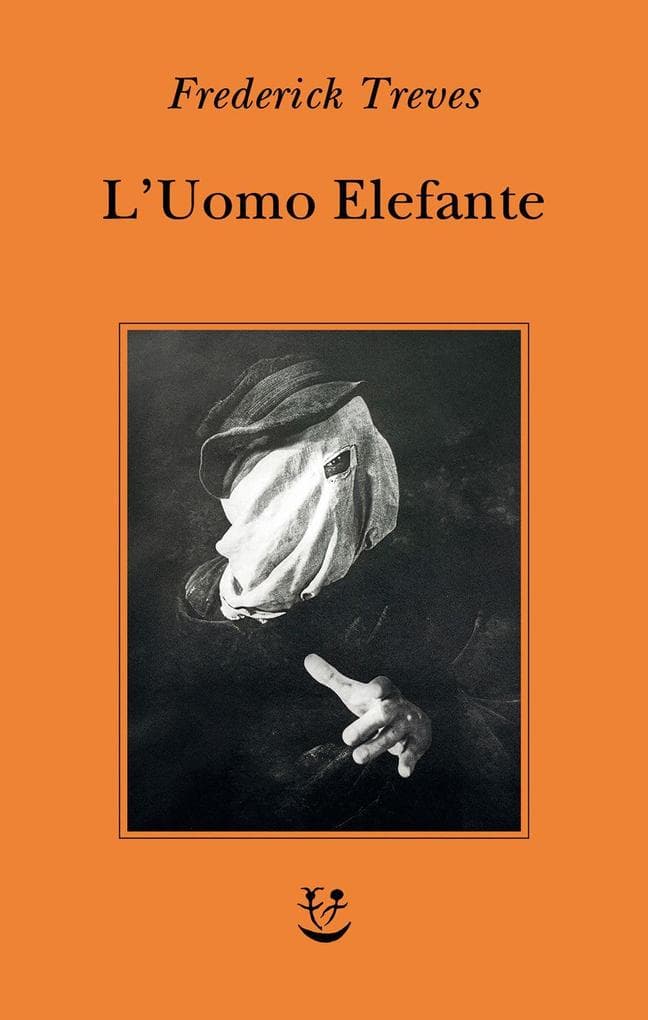 L' uomo elefante