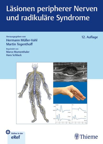 Läsionen peripherer Nerven und radikuläre Syndrome