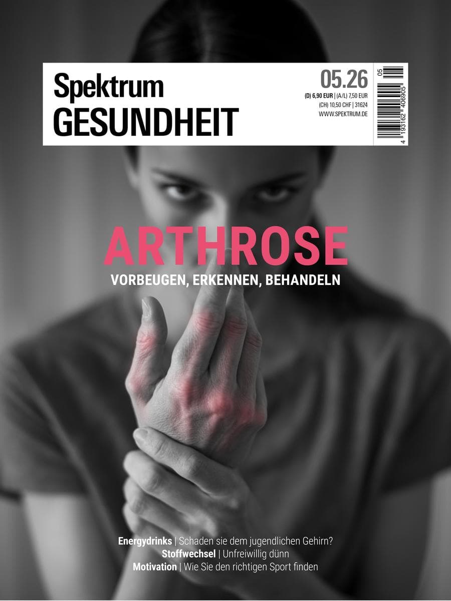 Spektrum Gesundheit 5/2026 - Arthrose