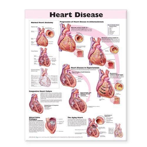 HEART DISEASE 2E PAPER CHART