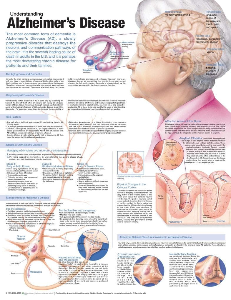 UNDERSTANDING ALZHEIMERS 2E PAPER CHART