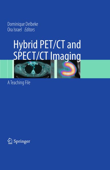 Hybrid PET/CT and SPECT/CT Imaging