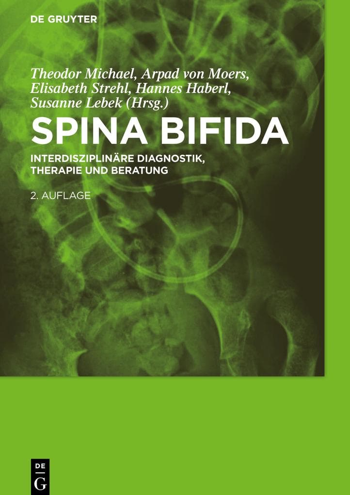 Spina bifida