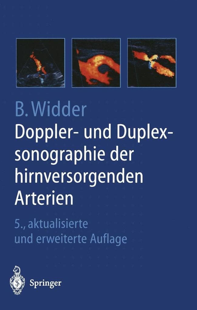 Doppler- und Duplexsonographie der hirnversorgenden Arterien