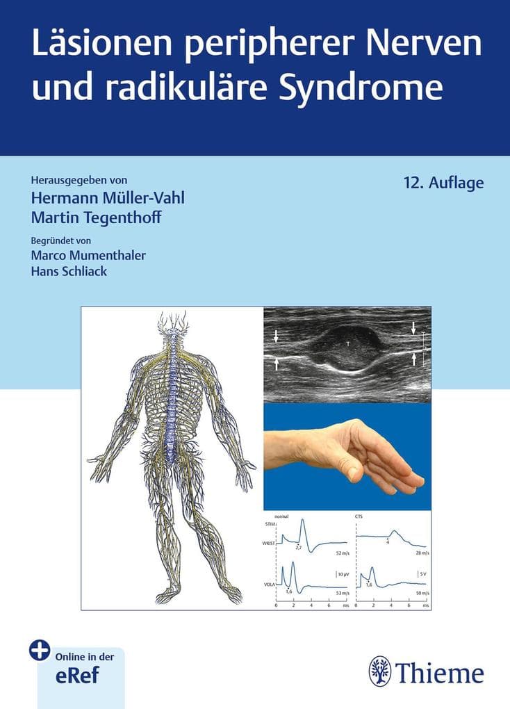 Läsionen peripherer Nerven und radikuläre Syndrome
